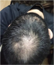 Before