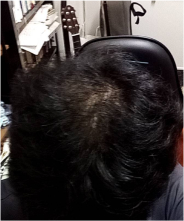 After