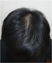 After