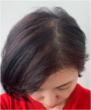 After