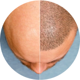 Point 1